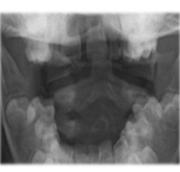 <p>What does this radiograph show?</p>