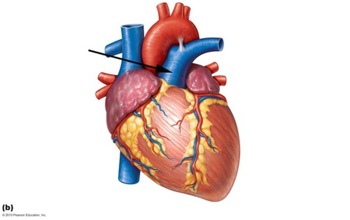 <p>Large vessel that carries deoxygenated blood from the right ventricle to the lungs.</p>