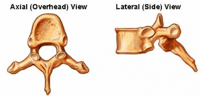 <p>What type of vertebra is this?  How do you know?</p>