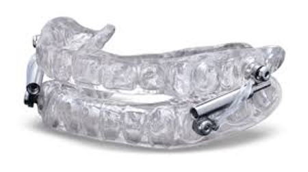 <p>What does this refer to </p><ul><li><p>Avoid EtOH and sedative medications</p></li><li><p>Optimal sleep position</p></li><li><p>Weight loss if “overweight”</p></li><li><p>CPAP</p></li><li><p>Oral appliances</p><ul><li><p>Mandibular advancement splint (MAS)</p></li></ul></li><li><p>Surgery to enlarge the airway</p></li></ul><p></p>