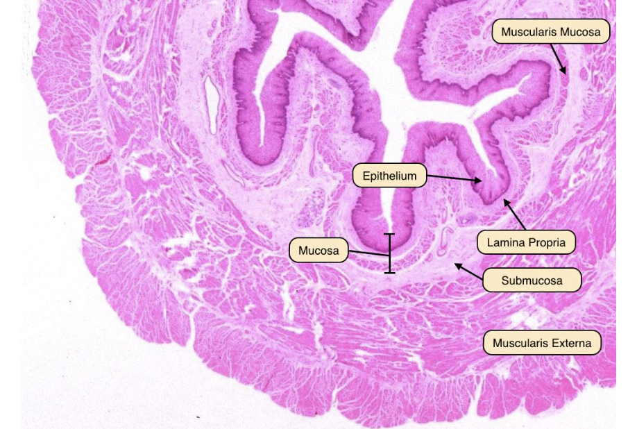 * **Epithelial lining; underlying lamina propria**.
* **Loose connective tissue, lymphocytes, +/- glands**
* Muscularis mucosae 

 