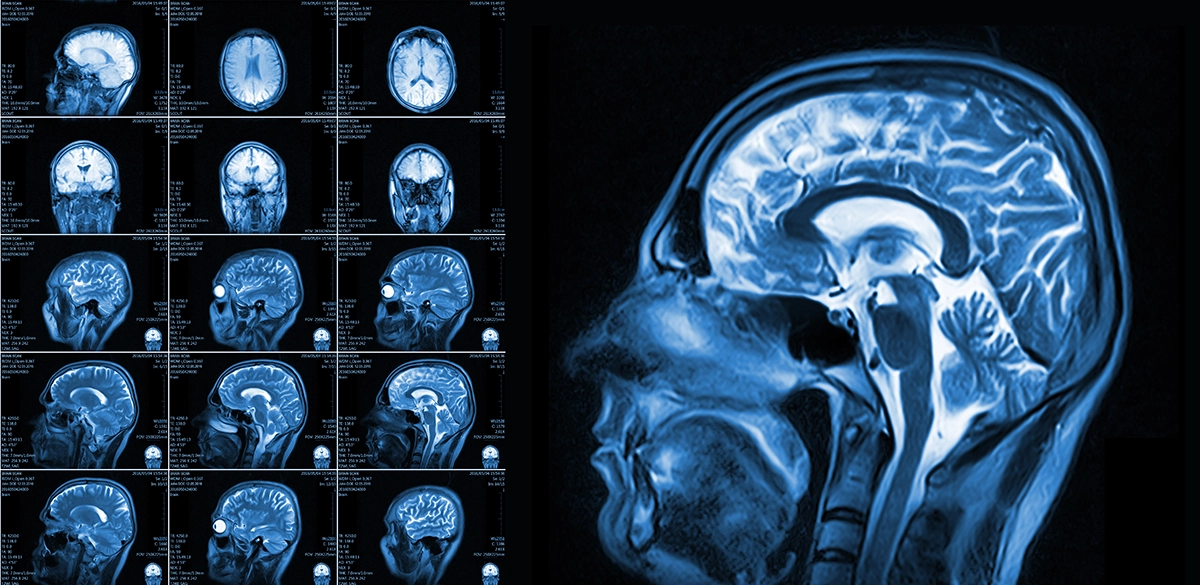 <p>body and brain tissue, uses magnetic fields and special radio receivers</p>