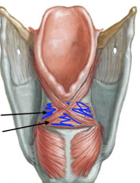 <p>What is this muscle?</p>