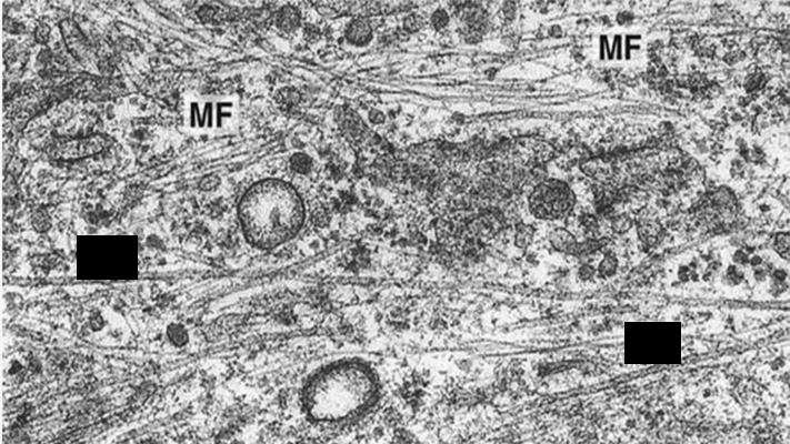 <p>Identify the specific structure</p>