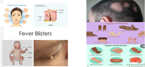 <p>Fever Blisters </p><p>Non- Contagious Disorders</p>