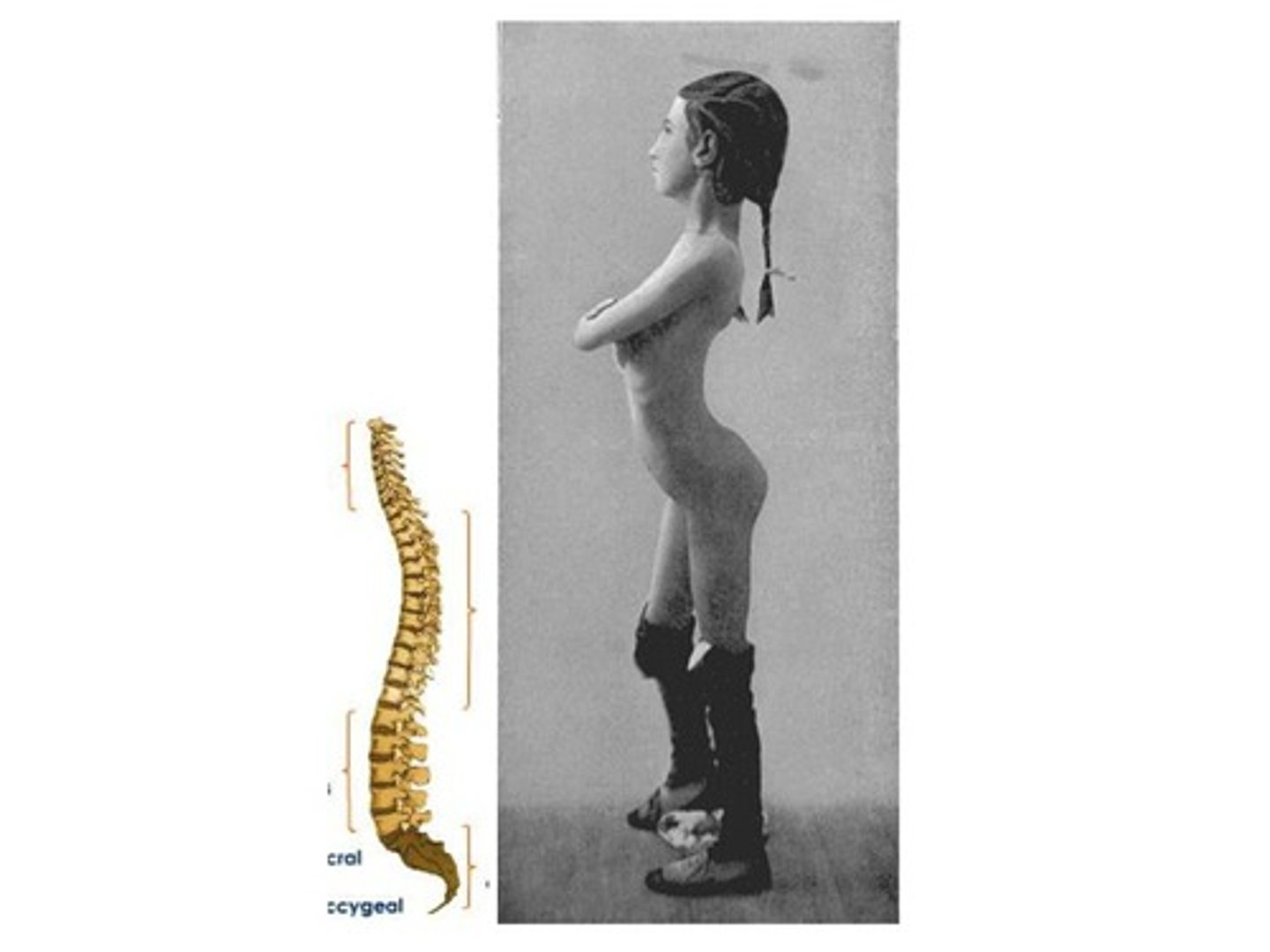<p>bent backward</p>