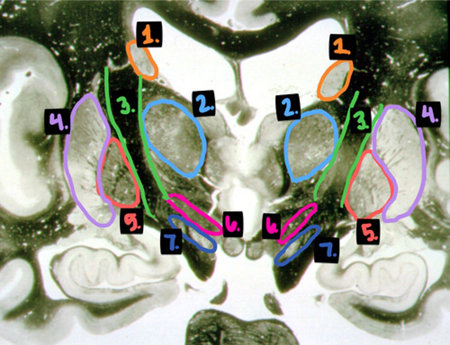 <p>which is the globus pallidus?</p>