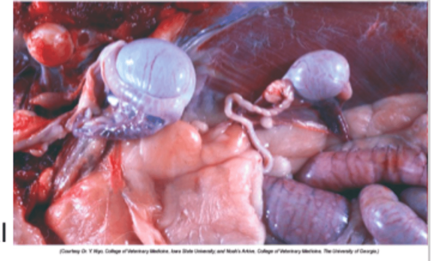 <p>Incomplete descent of the testis, they're retained between kidney, inguinal canal → in abd cavity</p><p>- Likely polygenetic basis, multiple gene mutations involved.</p><p>- Often hypoplastic (small testes due to arrested development)</p><p></p>