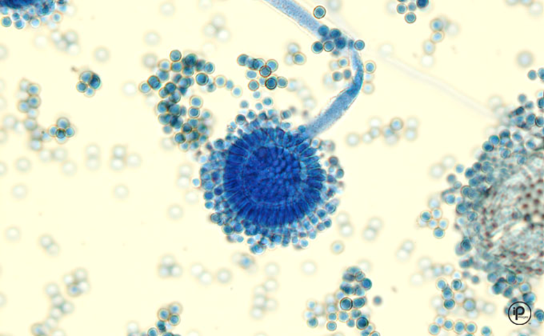 <p>Hyaline/Septate</p><p>Yellow-green to khaki/white</p><p>Biseriate phialides all around vesicle, round conidia </p><p>Produces aflatoxins, toxicosis </p>