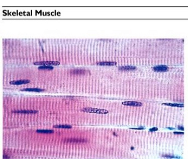 <ul><li><p>Muscle fibers; skeletal muscle cell</p></li><li><p>Location; attached to bones of skeleton</p></li></ul><p></p>