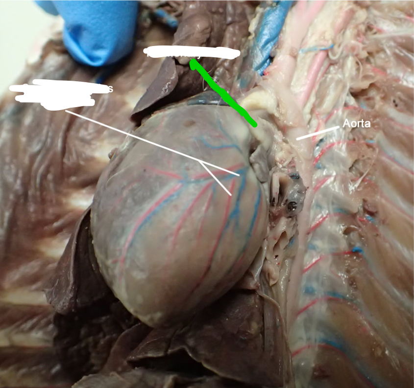 <p>Artery that attaches to right ventricle and sends blood to lungs to get oxygenated</p>