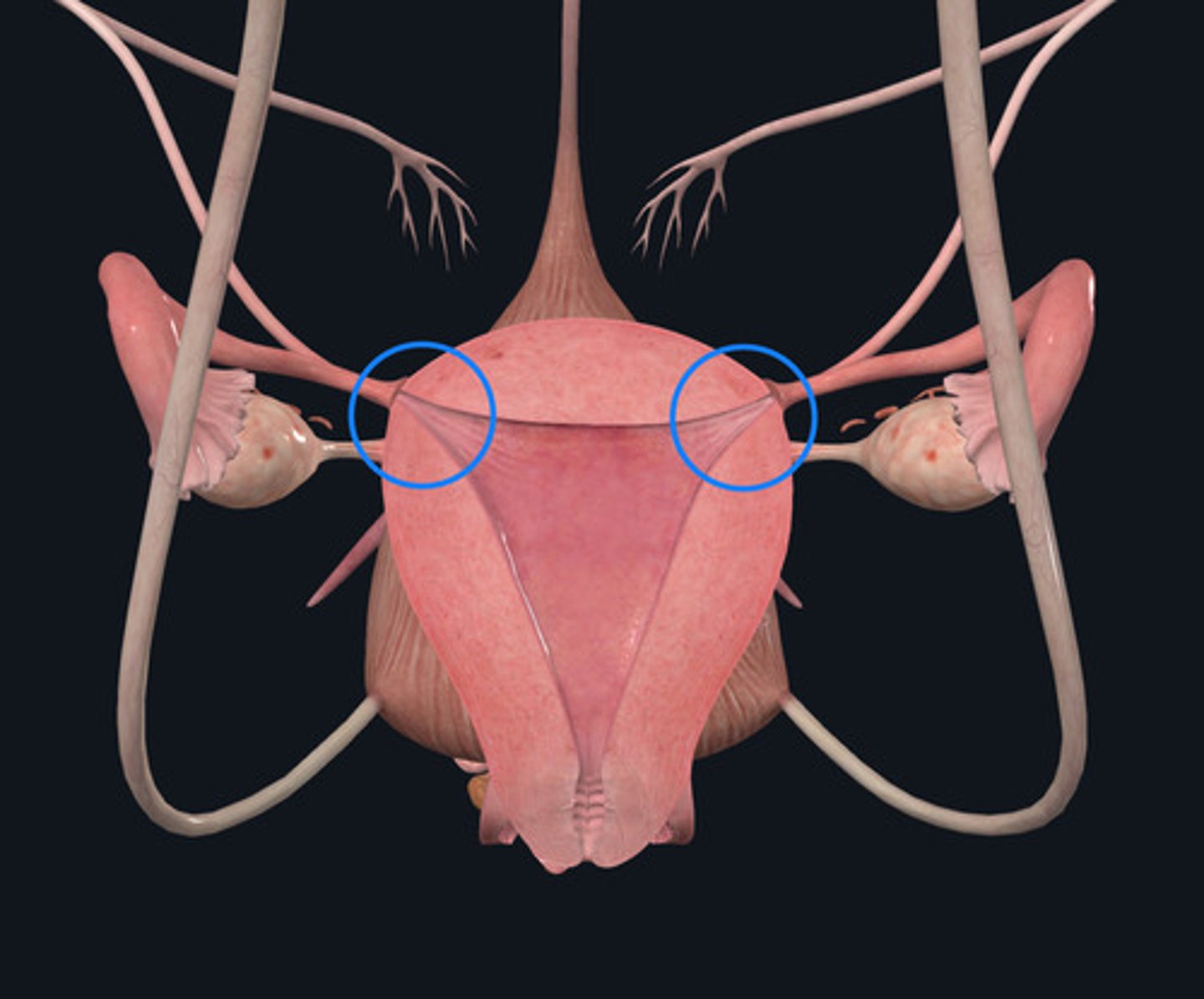 <p>ID Structural Landmarks Circled Blue</p>