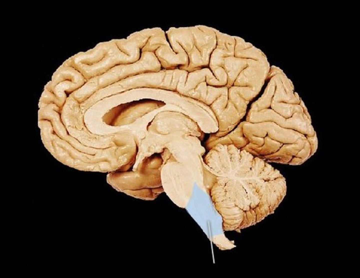 <p>part of brain stem, regulates heart rate, blood pressure, and breathing, and controls the reflexes of coughing, sneezing, and vomiting</p>