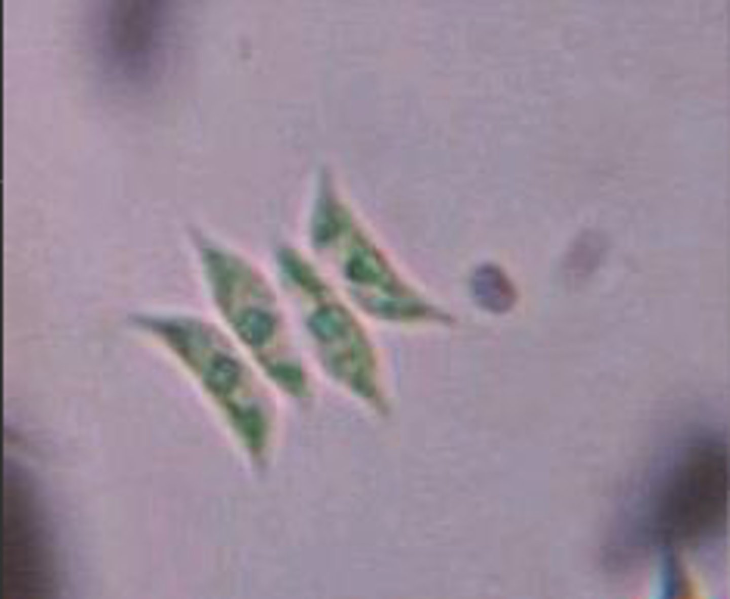 <p>Identify the Green alga shown (From Wikimedia Commons)</p>