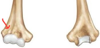 <p>humerus, much smaller dent away from curve, next to coronoid fossa</p>