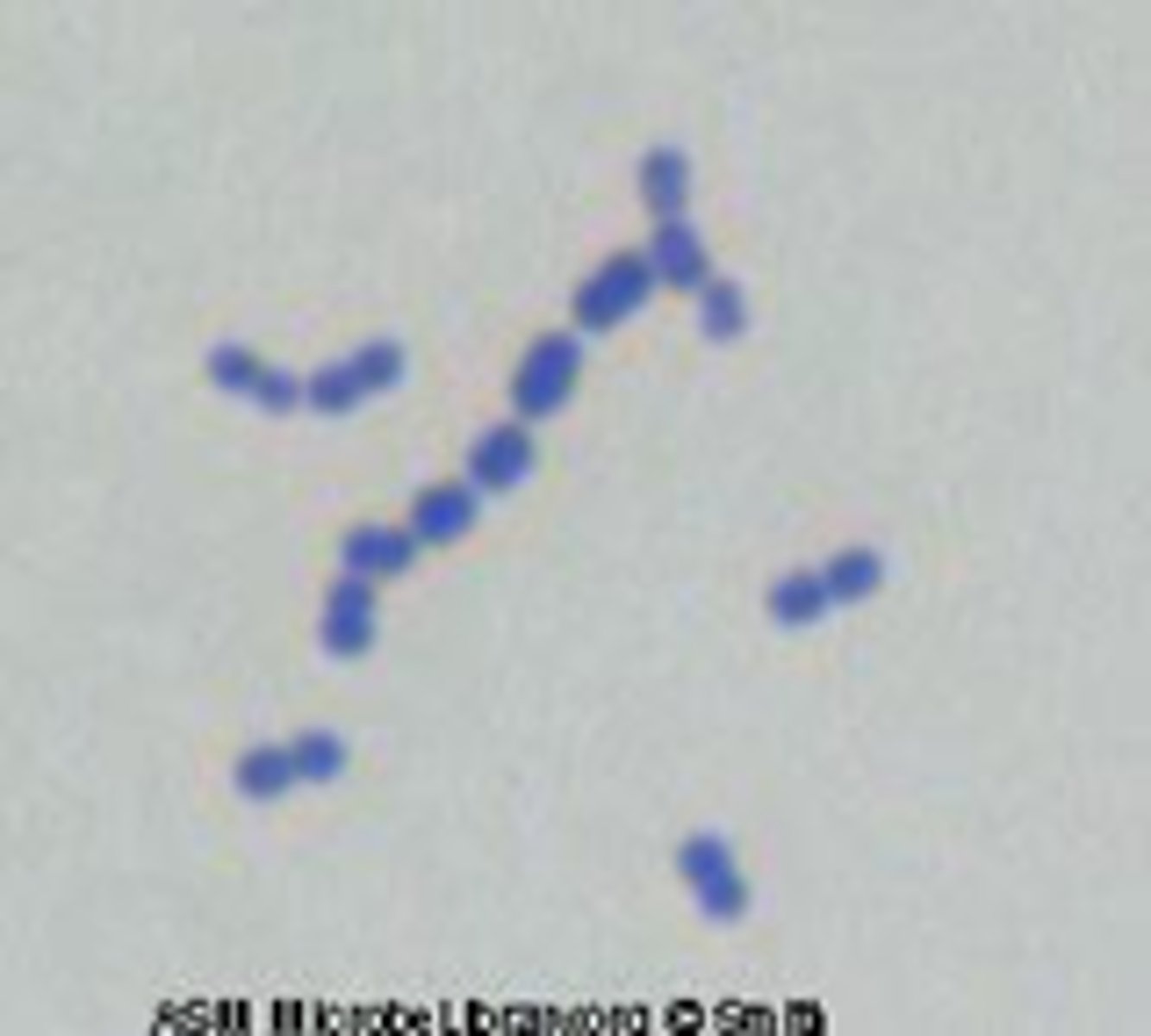 <p>- +ve cocci</p><p>- associated w/ biofilm formation and mild infections.</p><p>- can contribute to endocarditis following dental procedures</p><p>- optochin-resistant, alpha-hemolytic on blood agar</p>