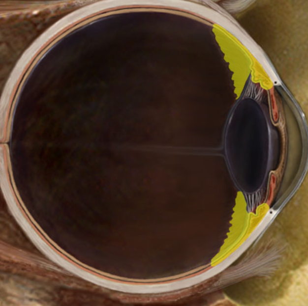 term image