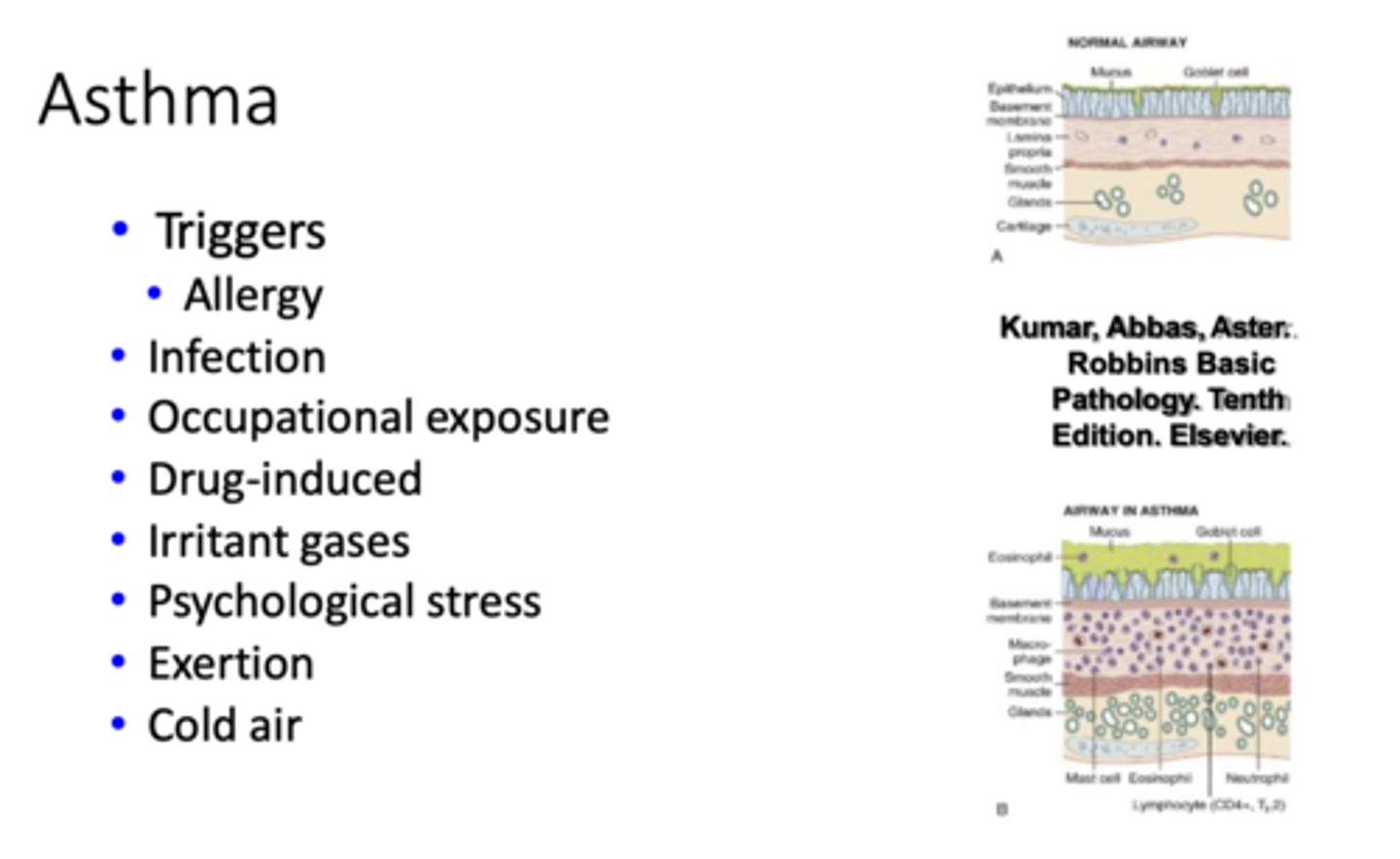 <p>Asthma</p>