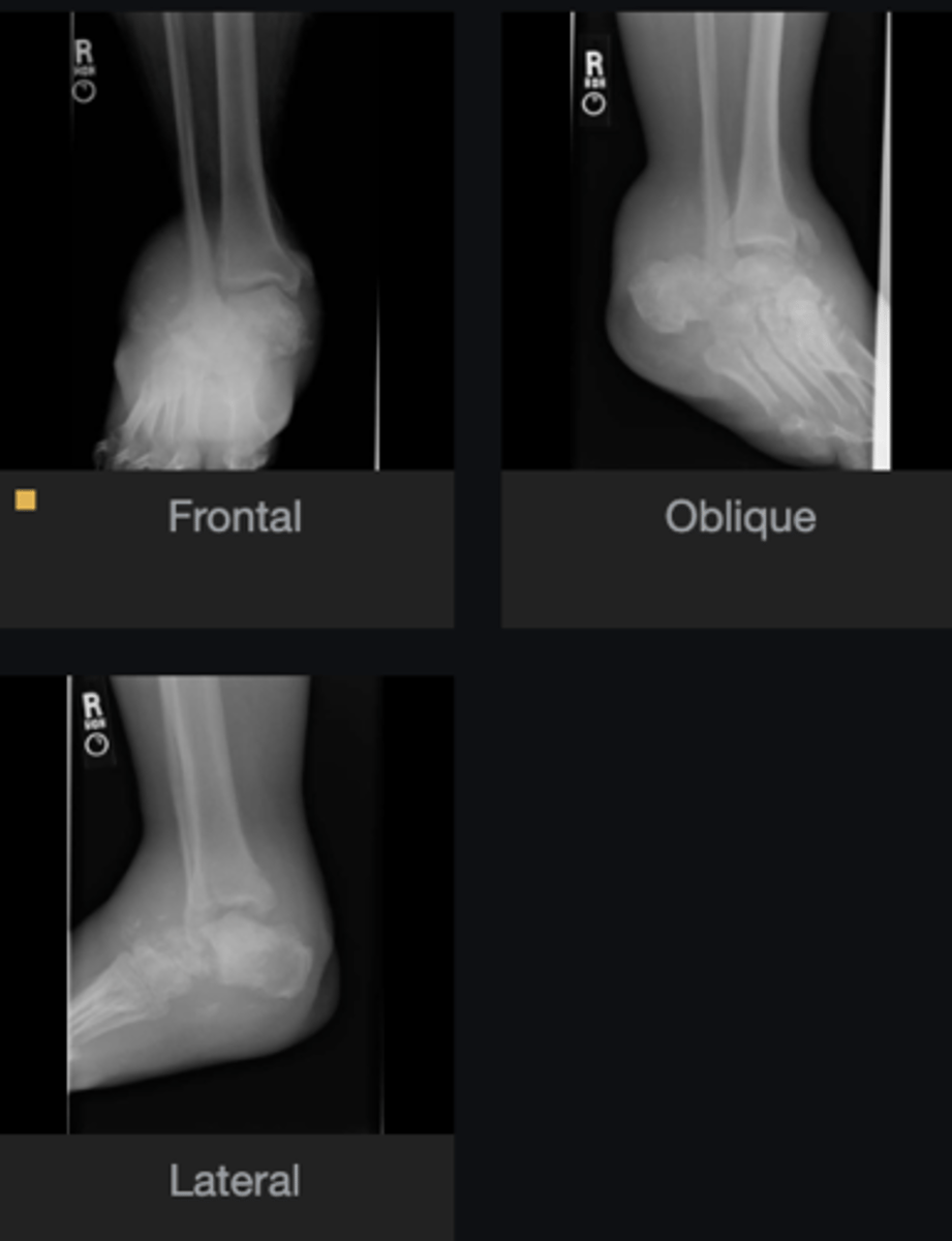 <p>- Diagnosis?</p><p>- What are some causes of this?</p>