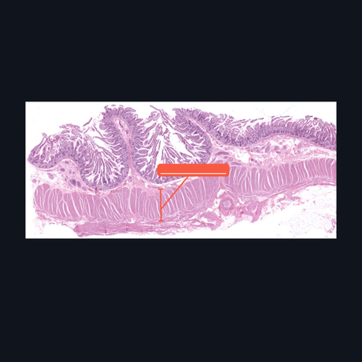 <p>Identify the pointed histologic layer of the digestive tract</p>