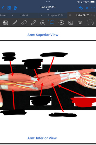 <p>What muscle is this?</p>