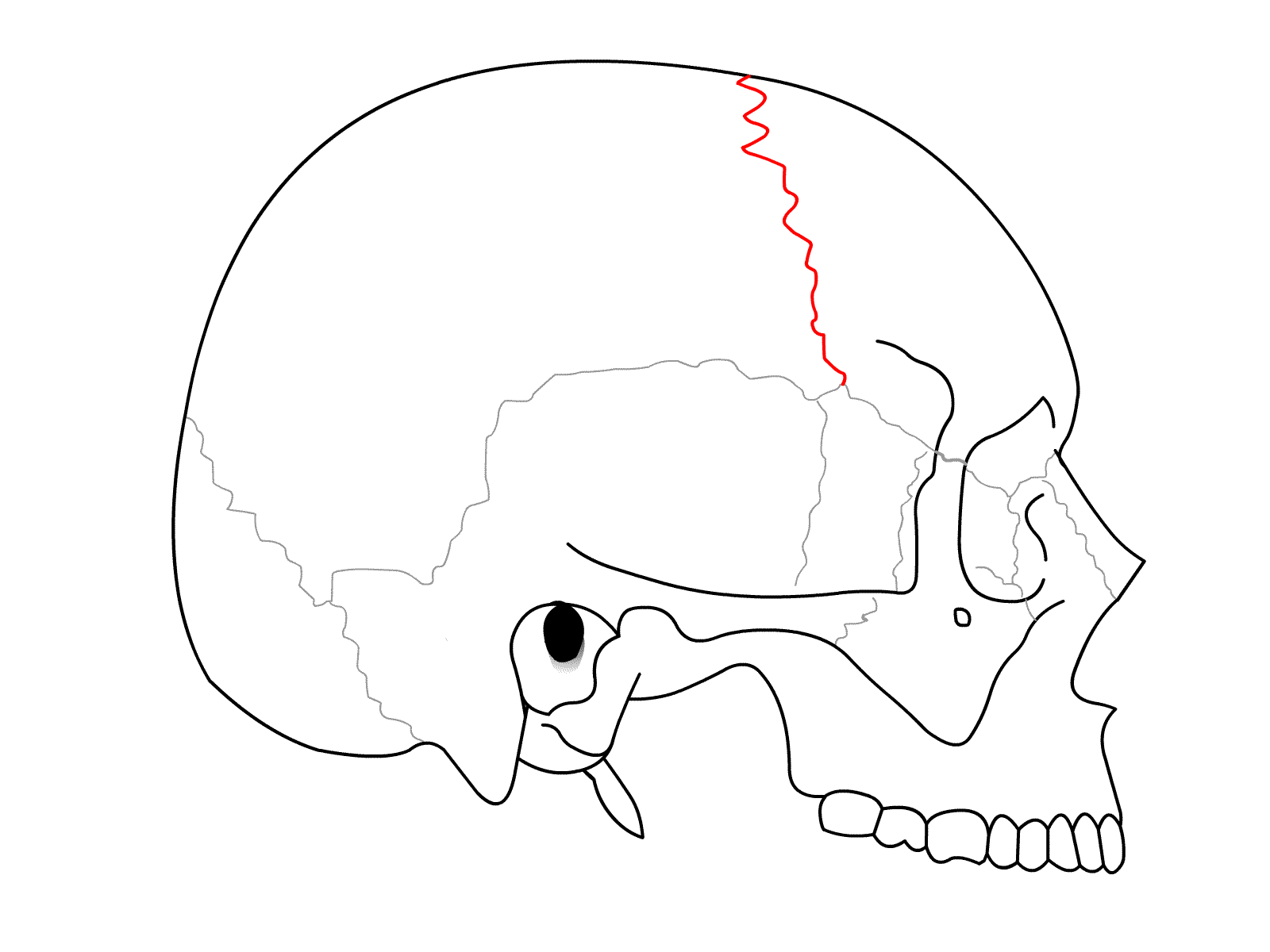 <p>coronal suture (lateral view)</p>