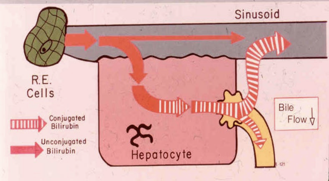 <p>A genetic disorder where the hepatocytes do not excrete conjugated bili into the biliary tract causing high levels of conjugated bili&nbsp;</p>