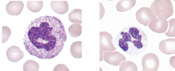 <p>what image (left or right) shows the cytoplasmic abnormality associated with the following:</p><ul><li><p>abnormal granules present</p></li></ul><p></p>