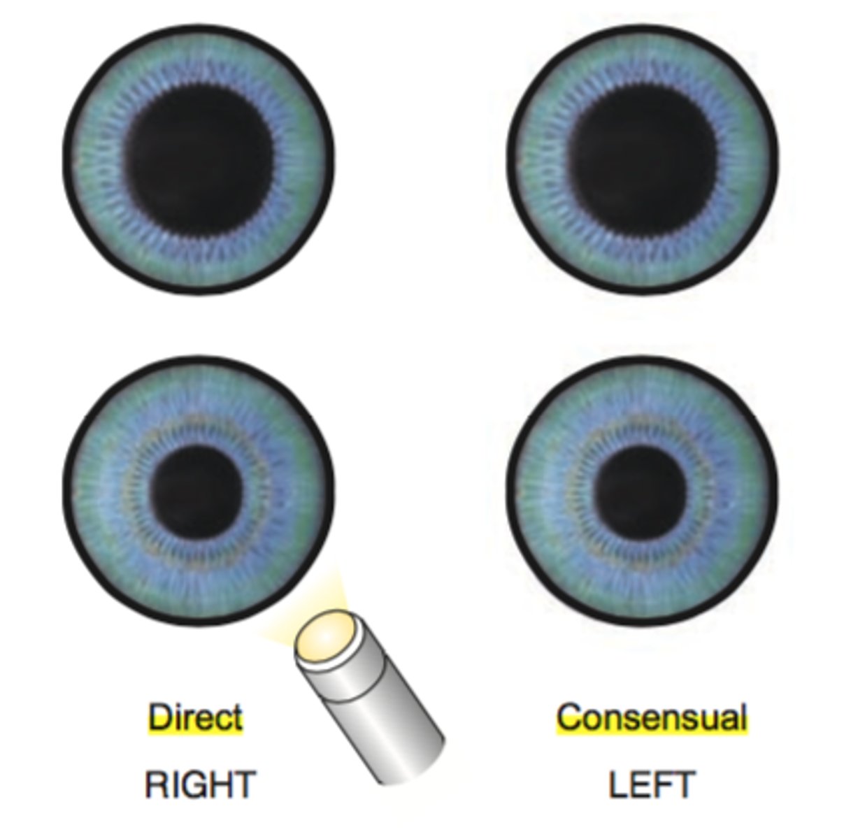 <p>both pupils constrict when light is directed at one eye</p>