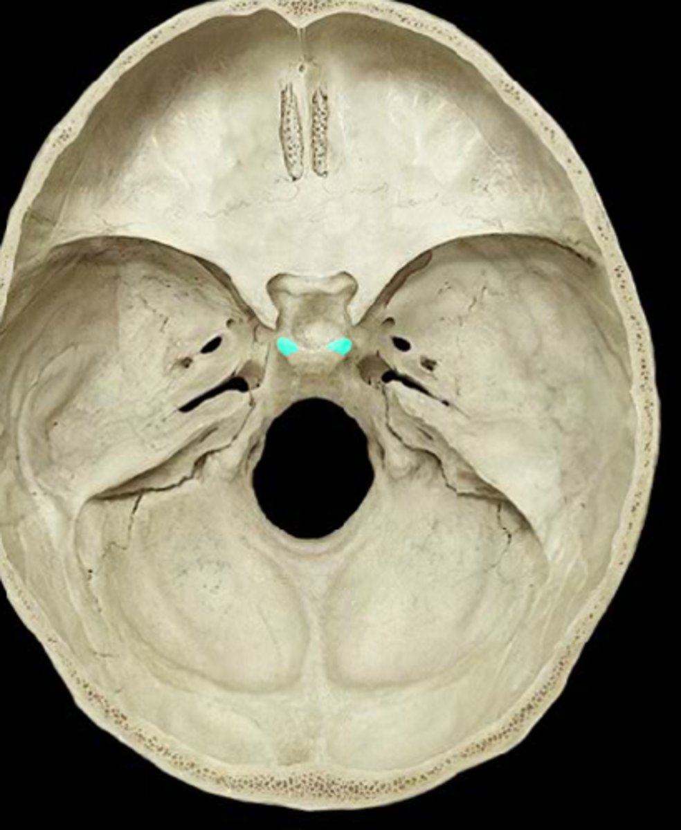 <p>The two highly variable tubercles located on the superolateral corners of the dorsum sellae</p>