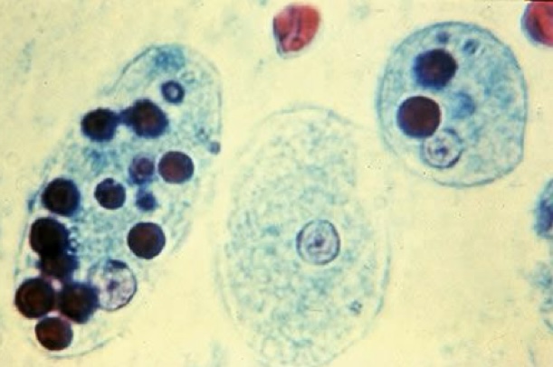 <p>Identify: Protozoa</p>
