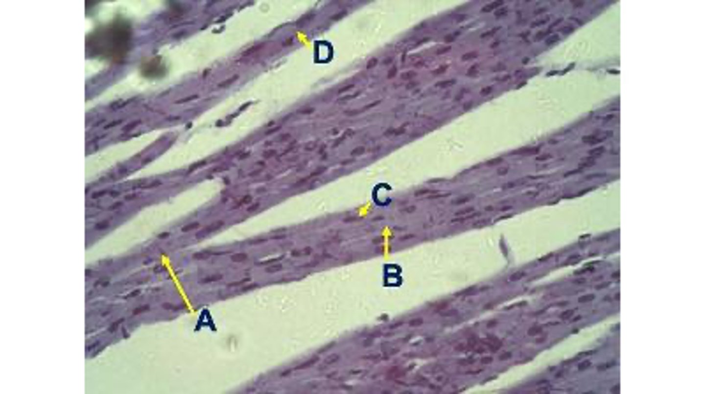 <p>What is structure D</p>