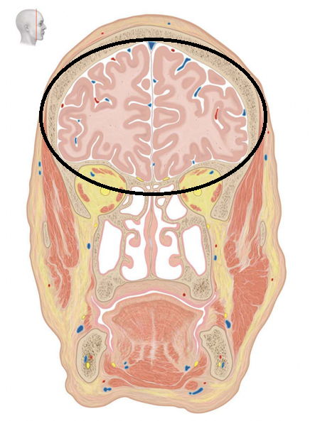 <p>hersenkwab</p>
