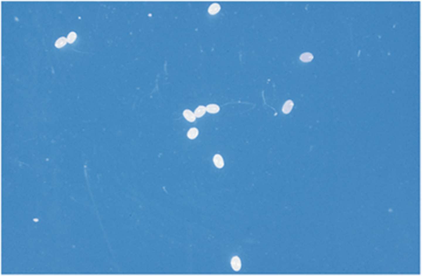 <p>The eggs of cat fleas appear as tiny pearls due to the fact:</p>
