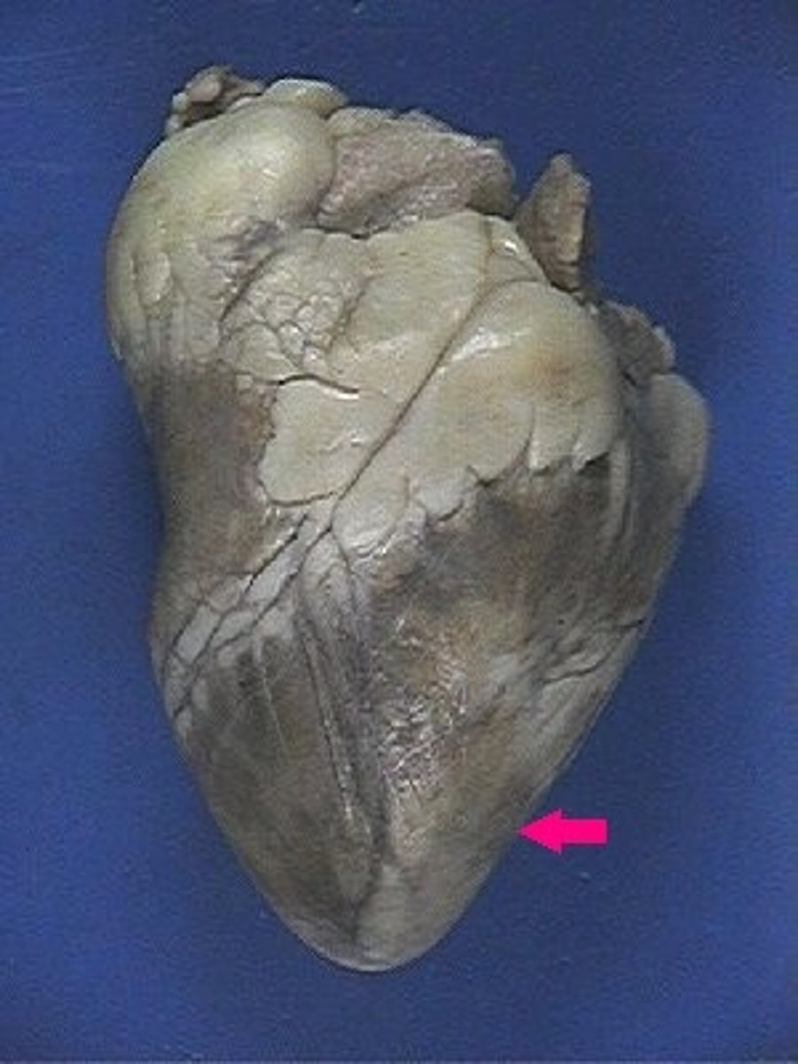 <p>Identify the surface layer.</p>