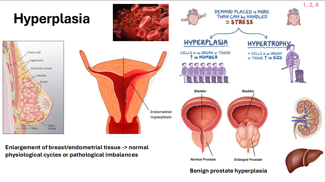 <p>Hyperplasia</p>