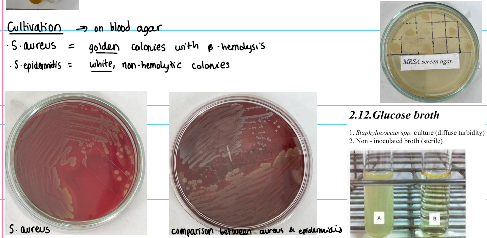 <p><strong>blood agar</strong></p><p>S. Aureus: golden with ß-hemolysis</p><p>S. epidermitis: white NO ß-hemolysis</p><p></p><p><strong>Glucose broth: </strong>turbidity</p><p></p><p><strong>MRSA Screen Agar: </strong>added antibiotics, if it growths - MRSA</p>