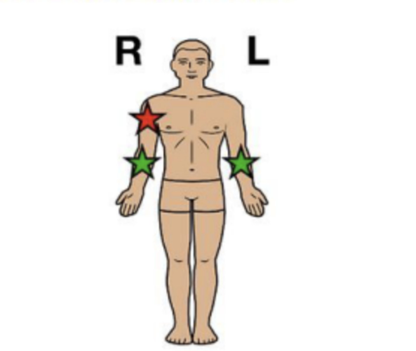 <p>involving one side of the body</p><p>"uni" = one</p><p>RED</p>