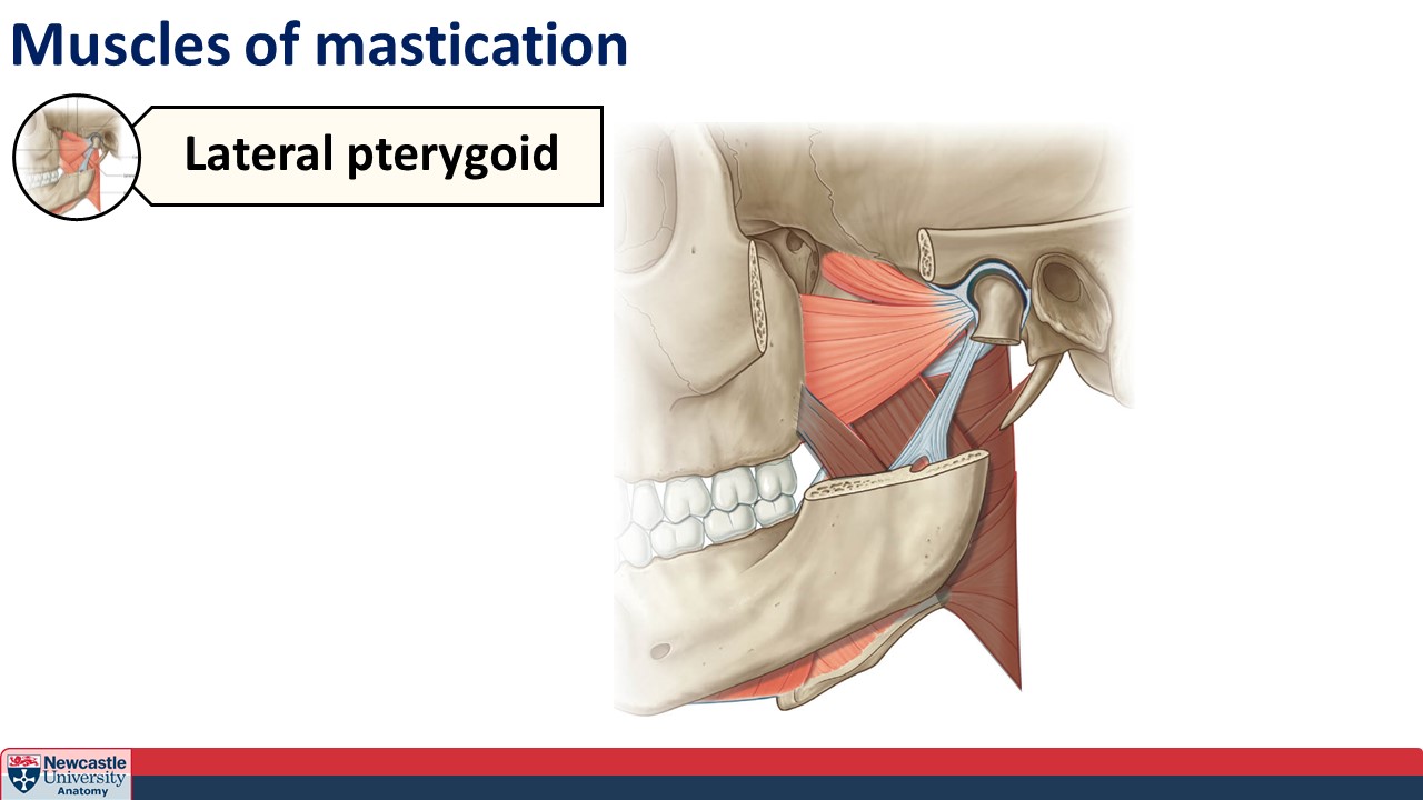 <p>Lateral pterygoid</p>