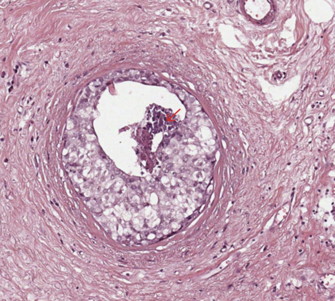 <p>Breast</p>