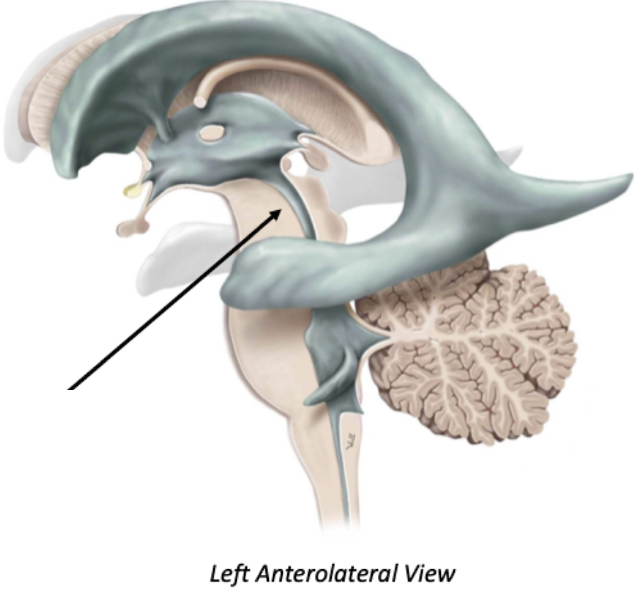 <p>Cerebral Aqueduct</p>