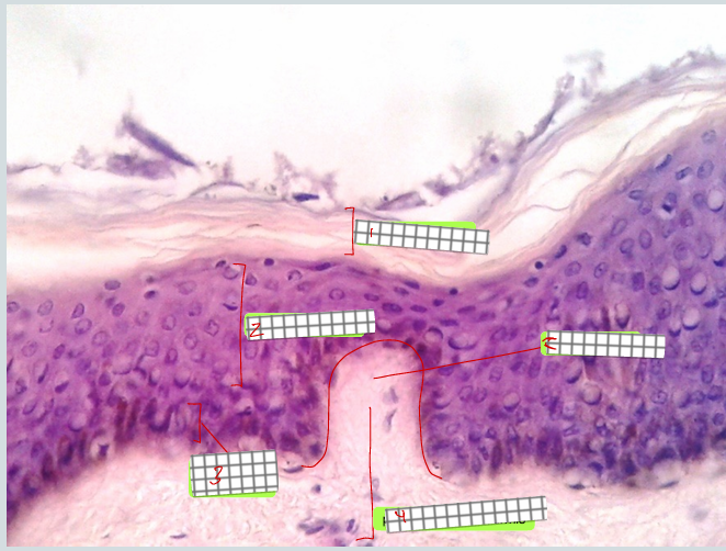 <p>specimen<br>type of skin:<br>due to this type of skin, it does not have this layer:<br><br>Label</p>