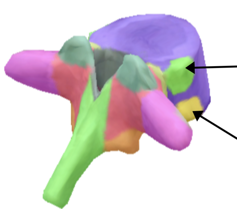 <p>Is this a cervical, thoracic or lumbar bone?</p>