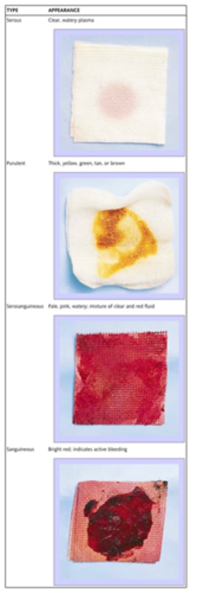 <p>combination of plasma, phagocytes, dead tissue cells, bacteria, fibrin, etc.</p>