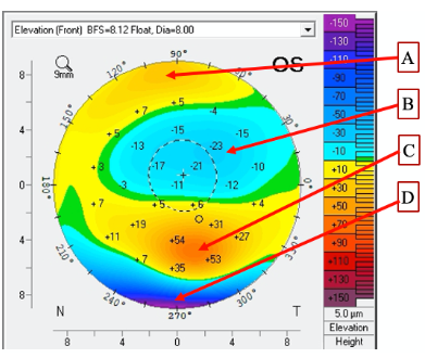<p><span>Look at the attached topography. &nbsp;Which point is the in lowest in terms of elevation relative to the reference sphere?</span></p>