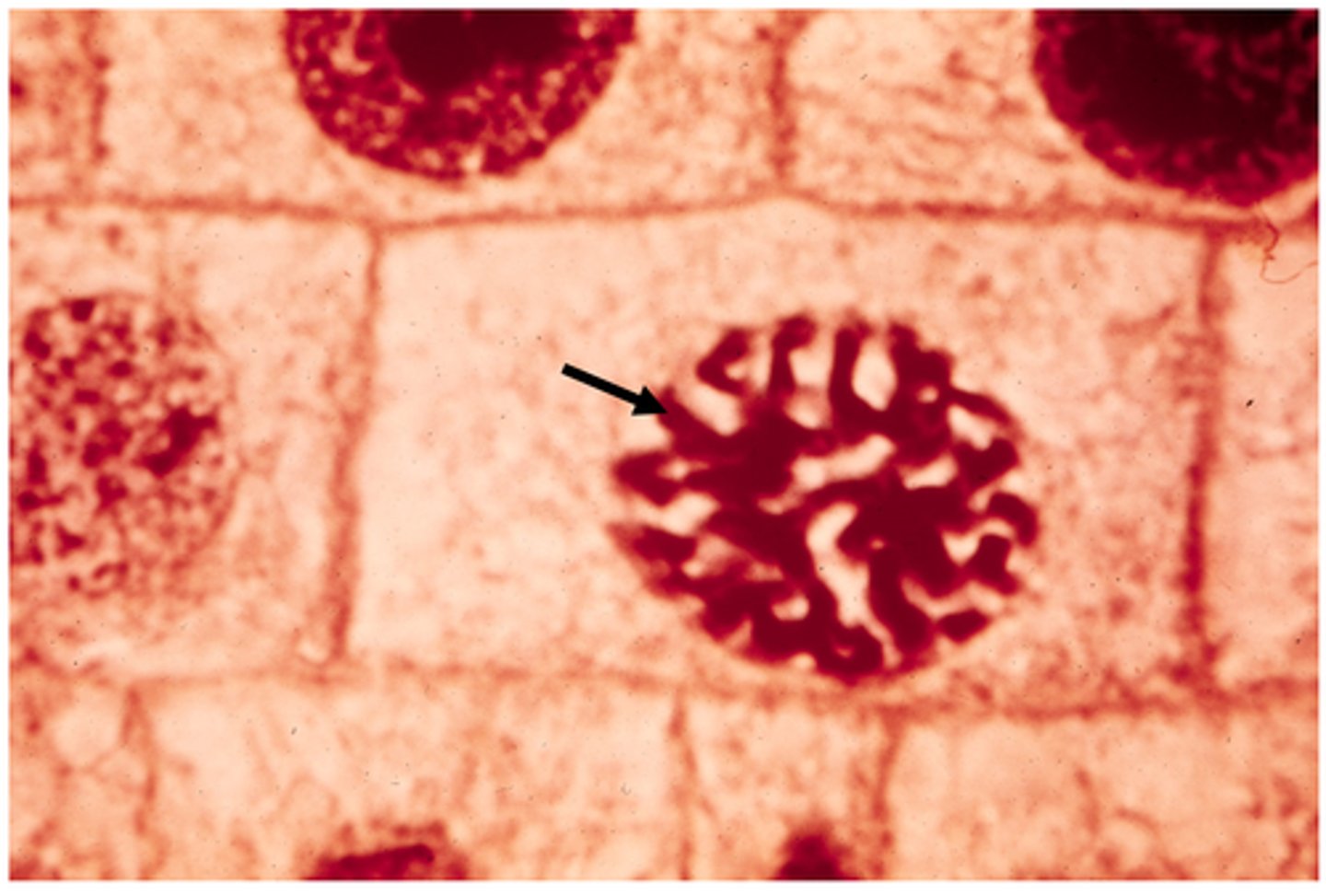 <p>This shows ________ in onion cells.</p>