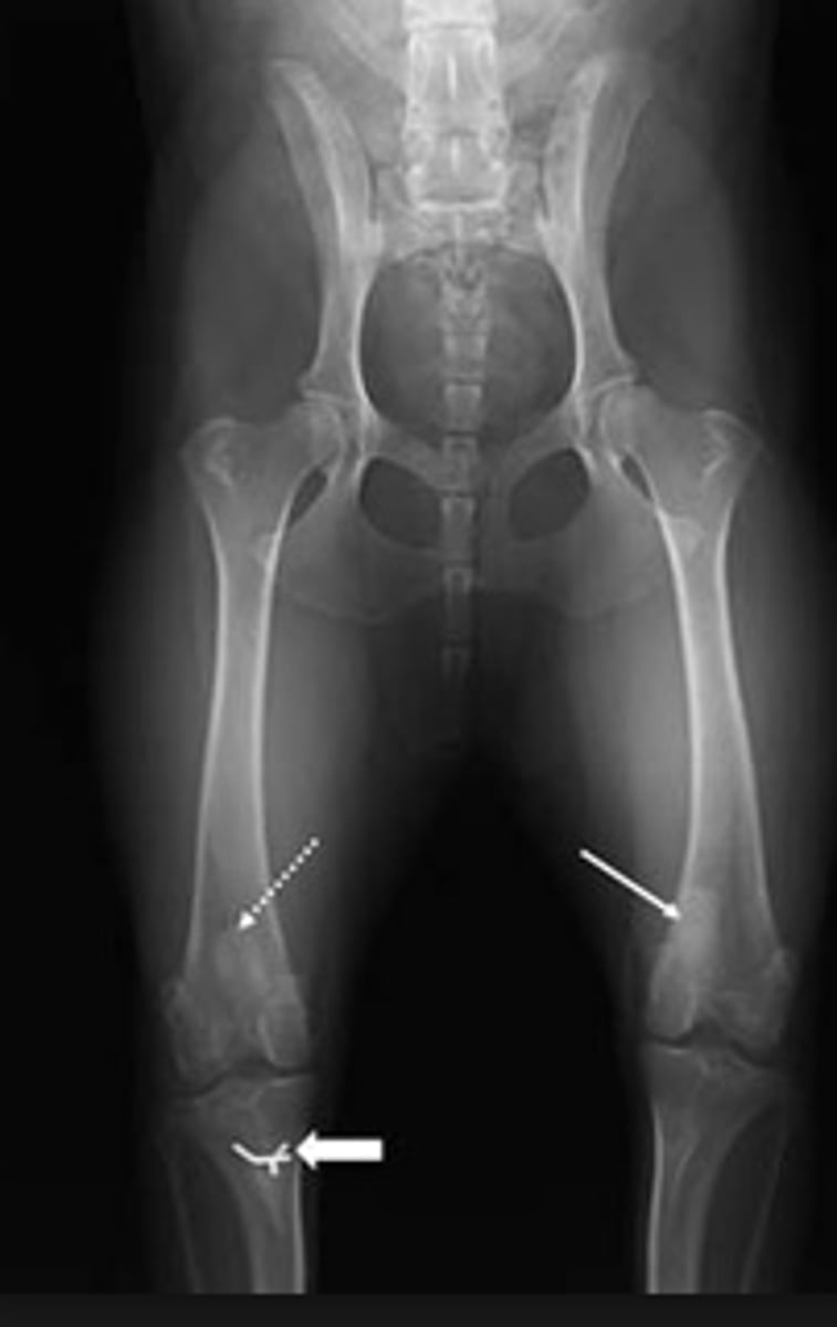 <p>Displacement of the stifle</p><p>Usually moves upward and to inside</p><p>Can be replaced</p><p>Recovery more likely if young</p>