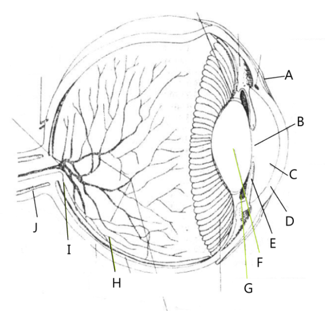 term image