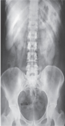 <p>What projection, position, and anatomy is this?</p>
