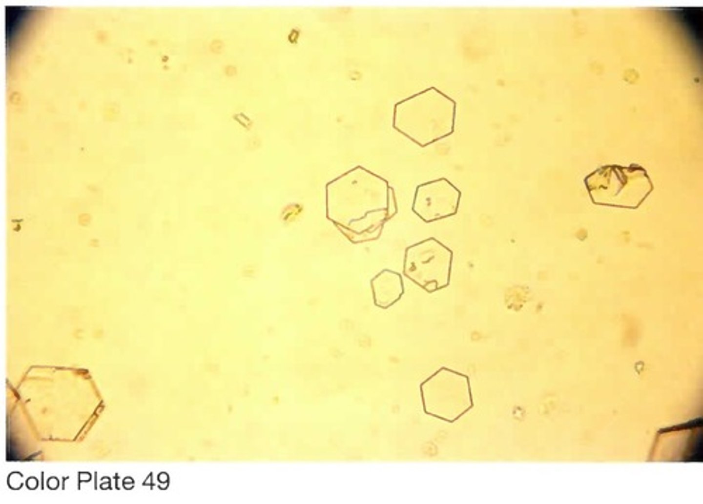 <p>B. Ornithine and arginine</p>